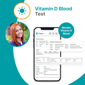 Vitamin D Test