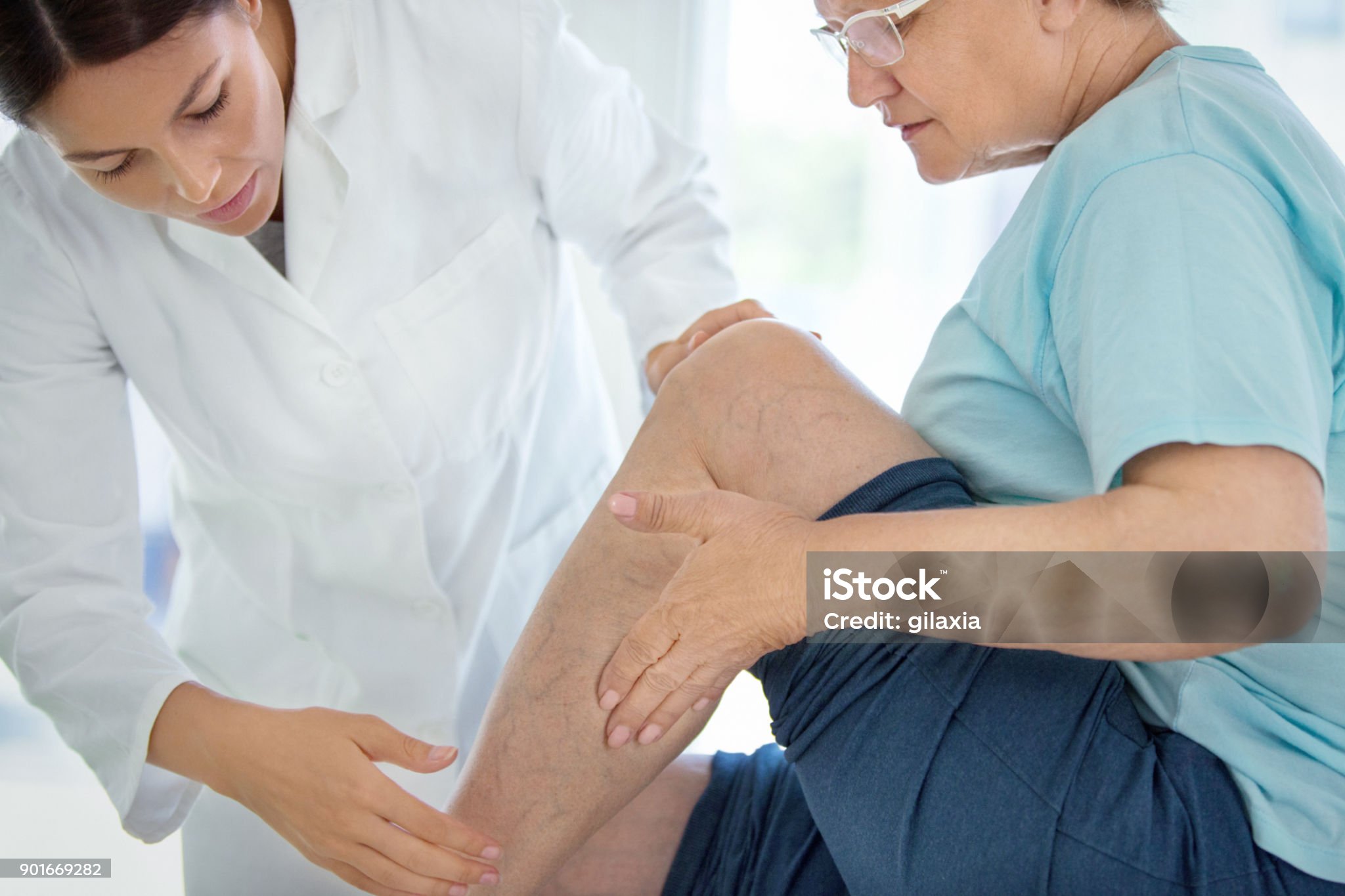 How Genetics and Lifestyle Together Influence Varicose Veins